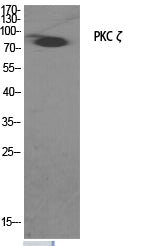 PKC zeta Rabbit Polyclonal Antibody