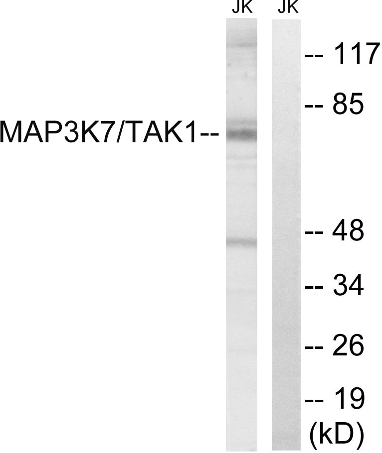 TAK1 Rabbit Polyclonal Antibody