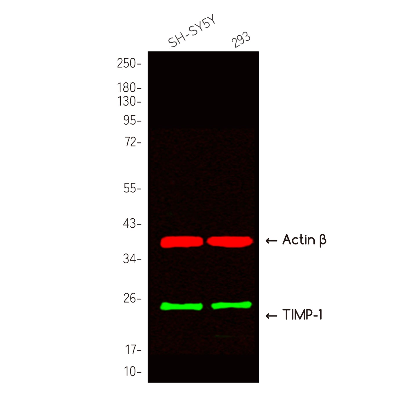 Metalloproteinase Inhibitor 1 Rabbit Polyclonal Antibody