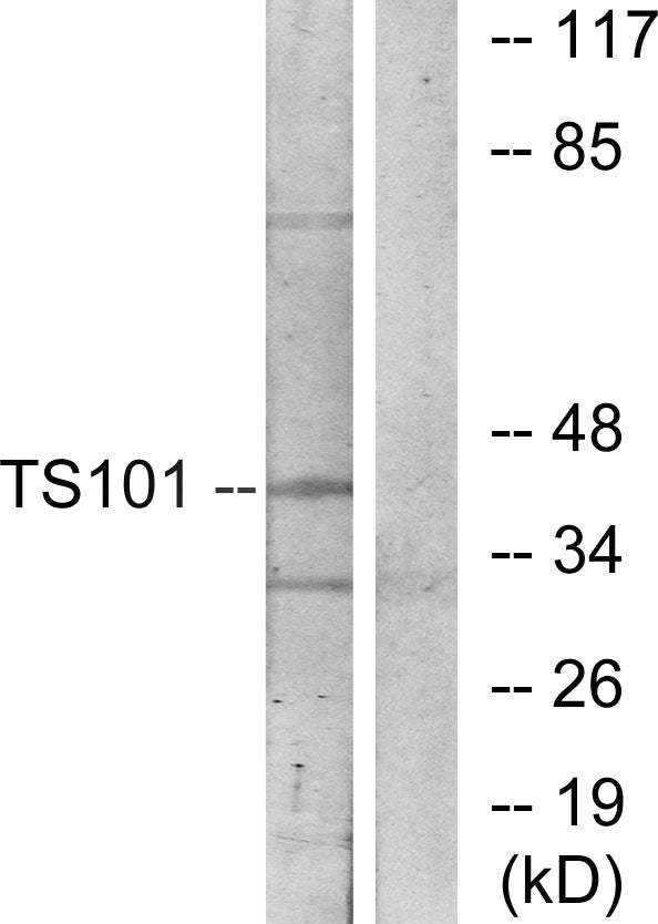 TSG101 Rabbit Polyclonal Antibody