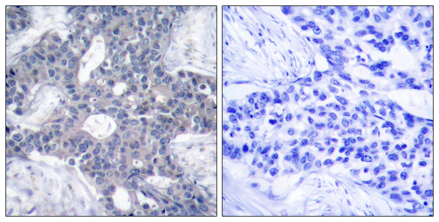 ZAP70 Rabbit Polyclonal Antibody