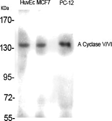 ADCY5/6 Rabbit Polyclonal Antibody