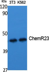CMKLR1 Rabbit Polyclonal Antibody