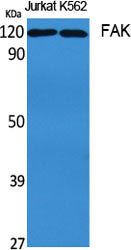FAK Rabbit Polyclonal Antibody