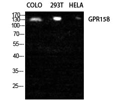 GPR158 Rabbit Polyclonal Antibody