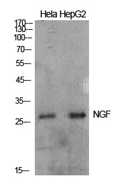 NGF Rabbit Polyclonal Antibody