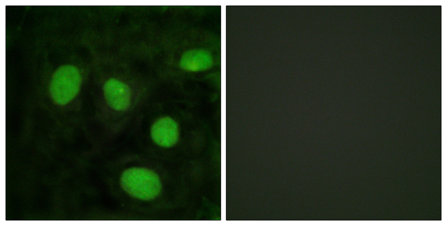 Histone H1.8 Rabbit Polyclonal Antibody