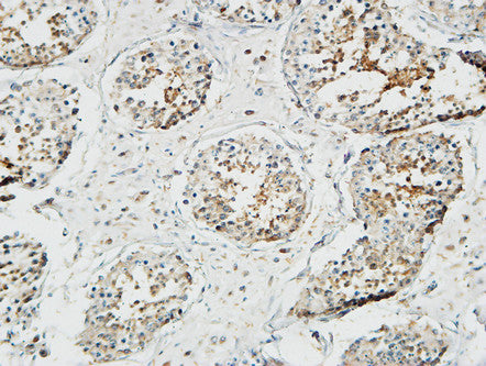 PTCH1 Rabbit Polyclonal Antibody