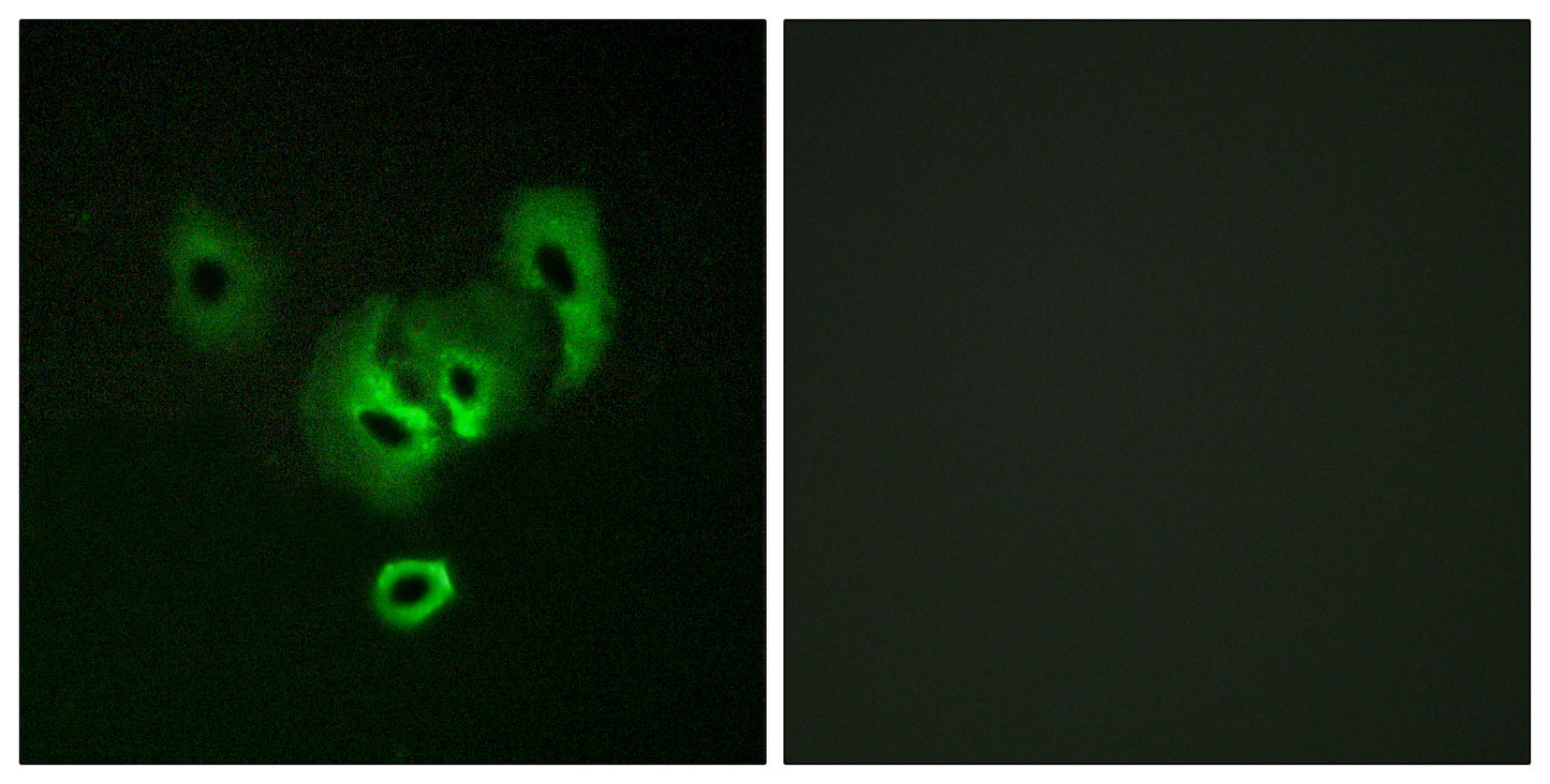 STEAP2 Rabbit Polyclonal Antibody