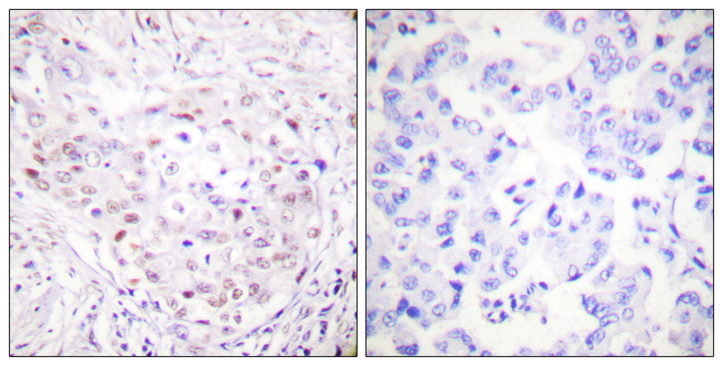 SENP3 Rabbit Polyclonal Antibody