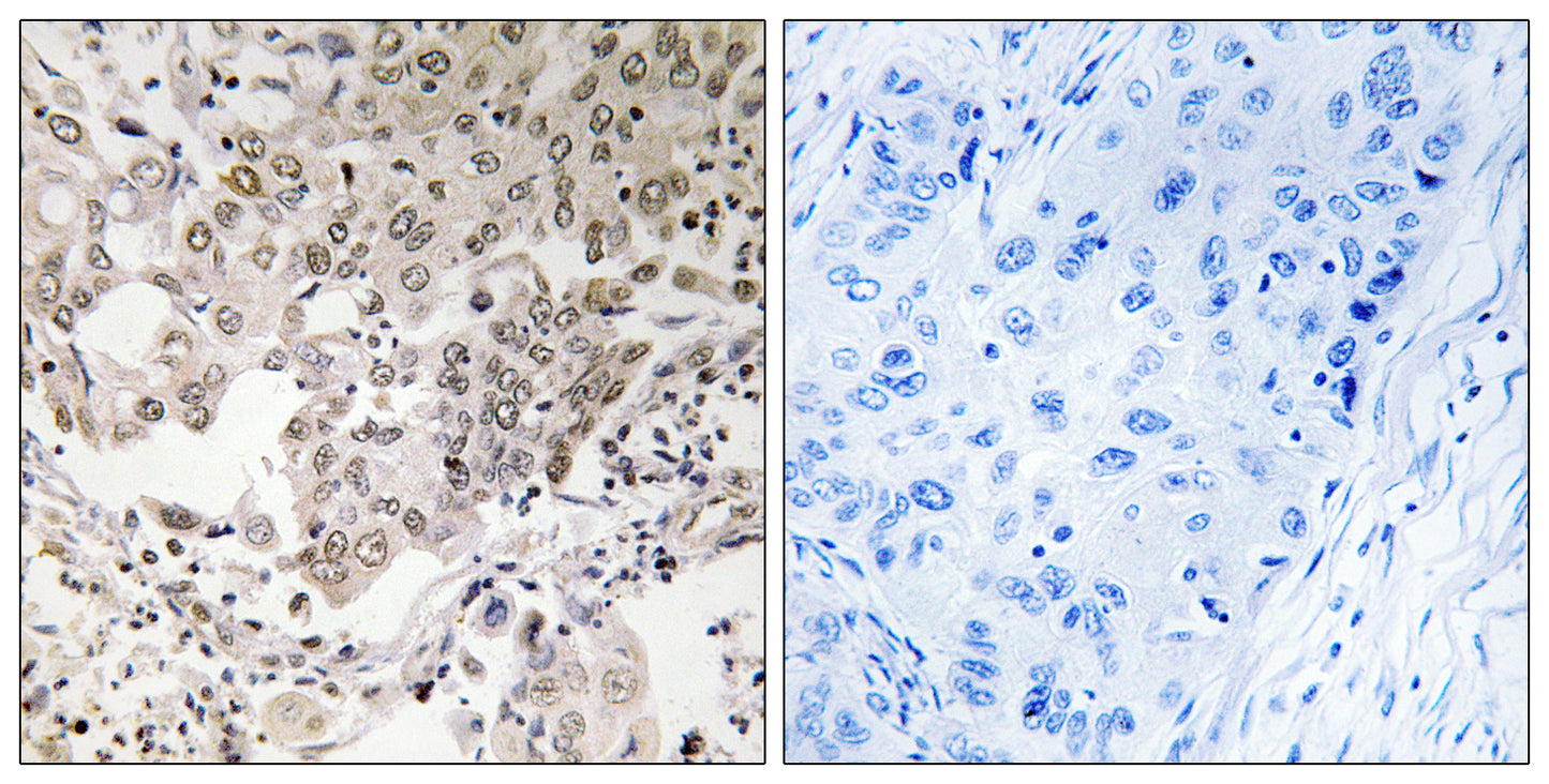 NCAPG2 Rabbit Polyclonal Antibody