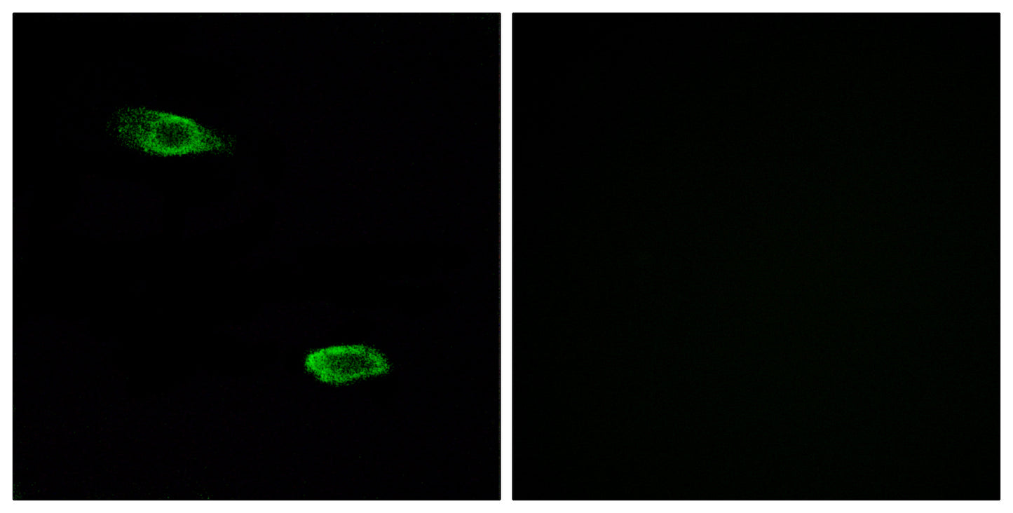 PSGR Rabbit Polyclonal Antibody