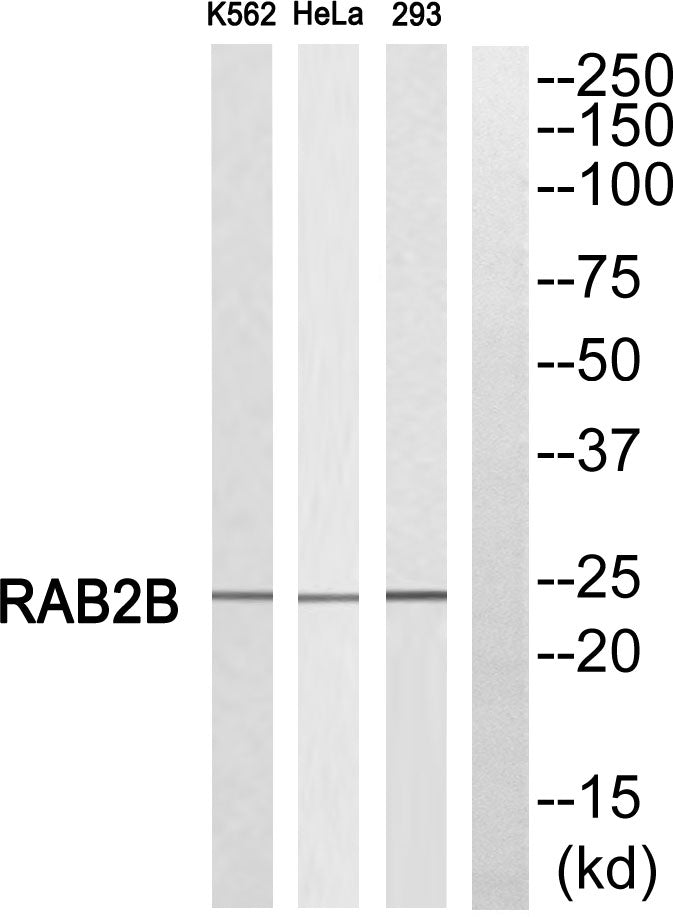Rab2B Rabbit Polyclonal Antibody