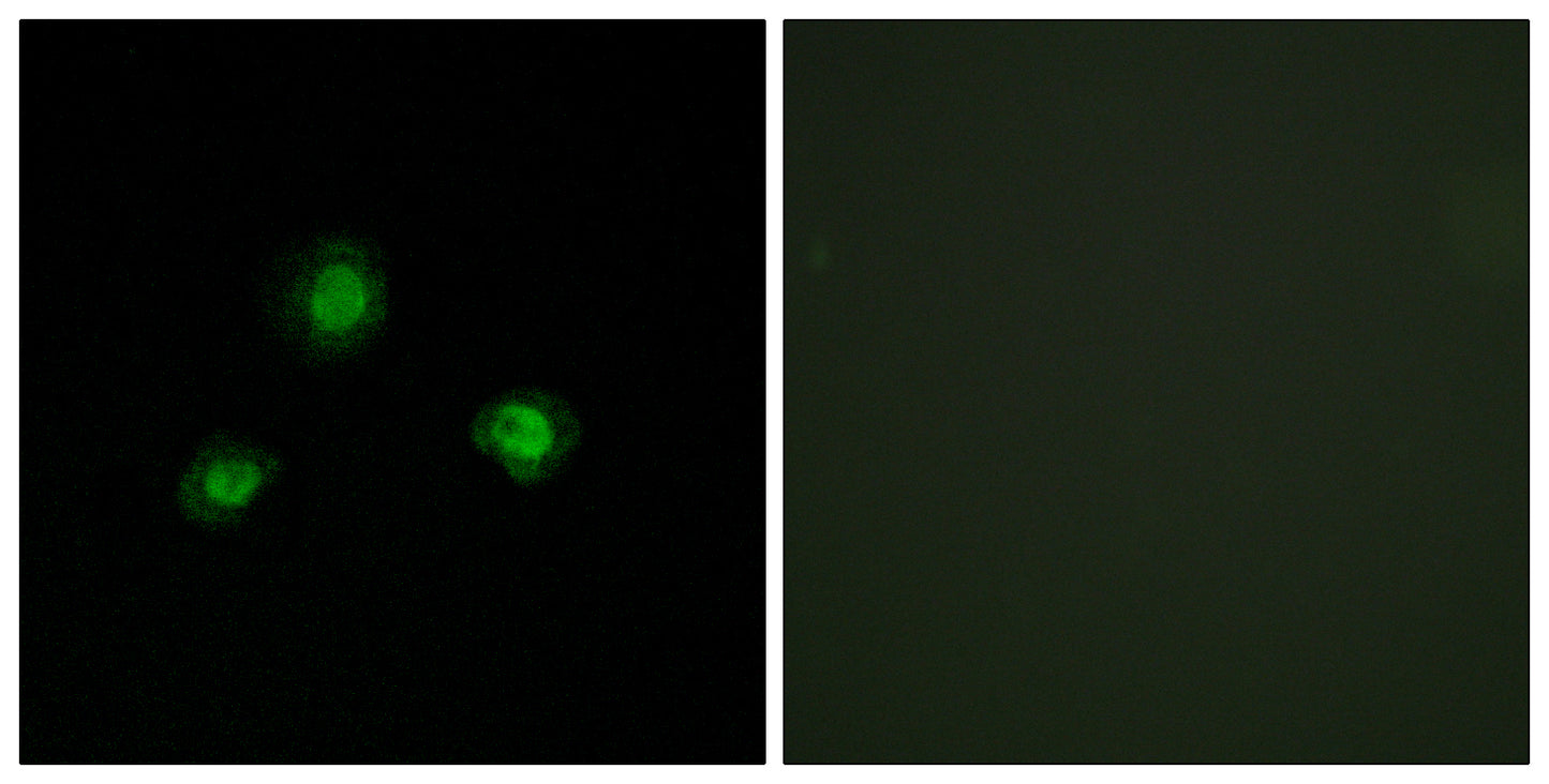 Ubinuclein 1 Rabbit Polyclonal Antibody