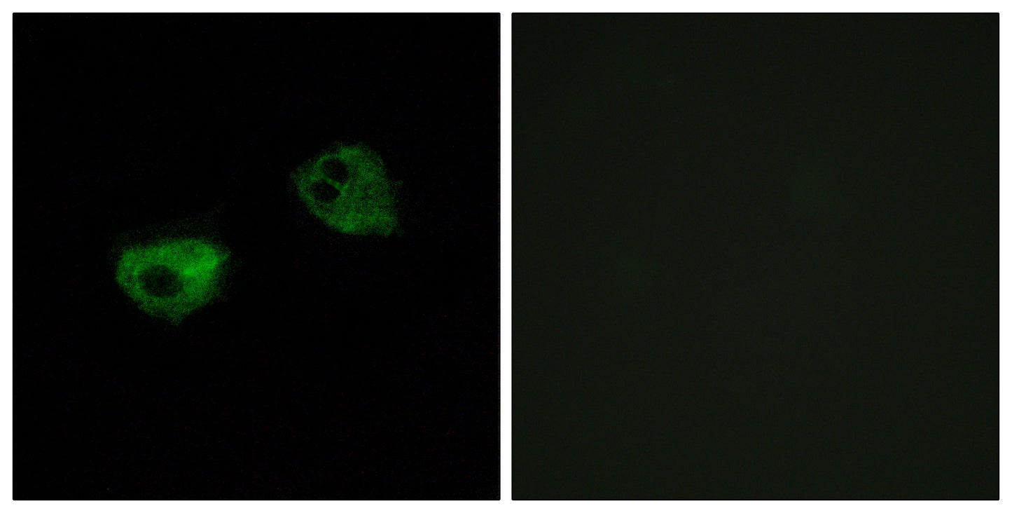 Melatonin Receptor 1A Rabbit Polyclonal Antibody