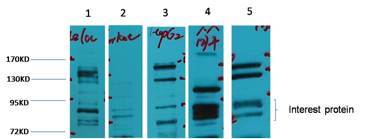 Glucocorticoid Receptor Rabbit Polyclonal Antibody