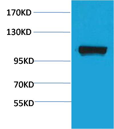 PEPC Rabbit Polyclonal Antibody