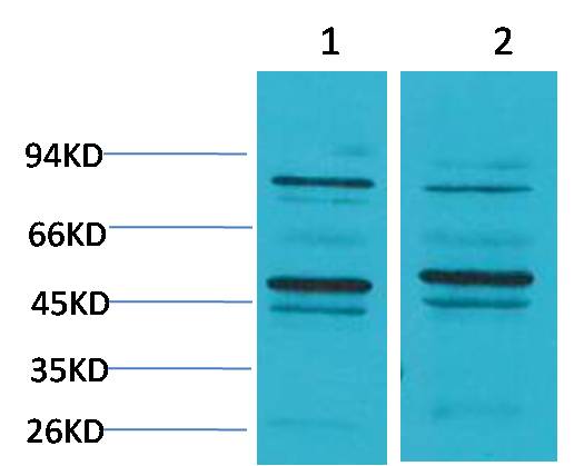 Bestrophin 2 Rabbit Polyclonal Antibody