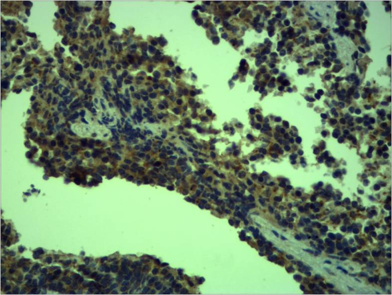 Toll-Like Receptor 4 Rabbit Polyclonal Antibody