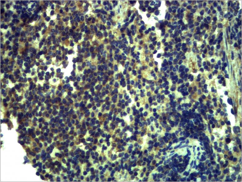Toll-Like Receptor 13 Rabbit Polyclonal Antibody