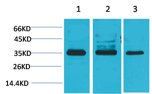 Cav gamma 4 Rabbit Polyclonal Antibody