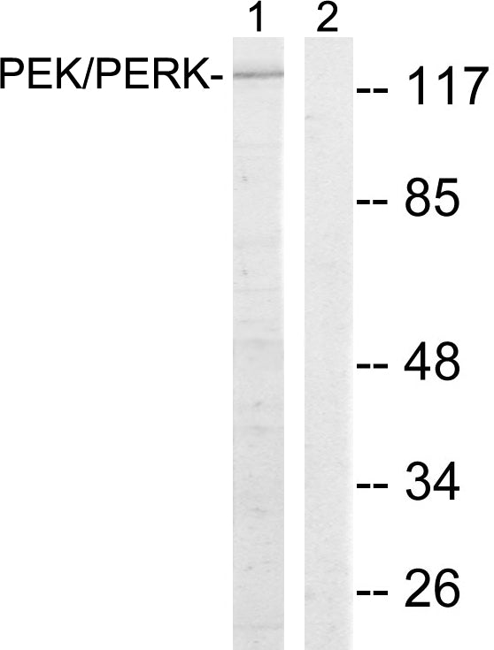 PERK Rabbit Polyclonal Antibody