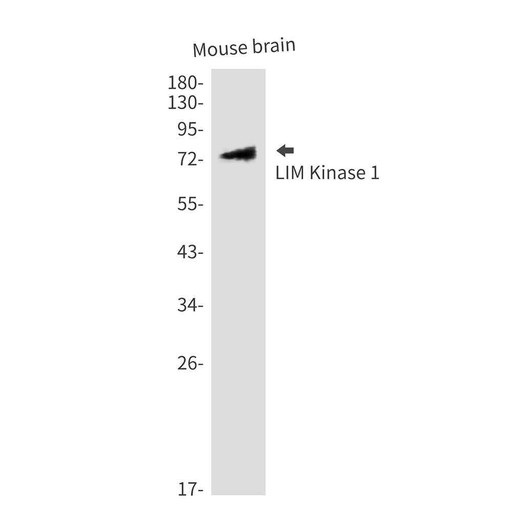 LIM Kinase 1 Rabbit Polyclonal Antibody