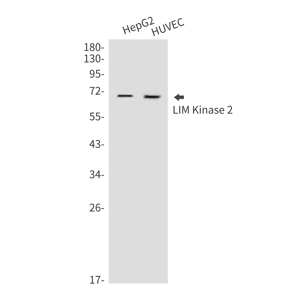 LIM Kinase 2 Rabbit Polyclonal Antibody