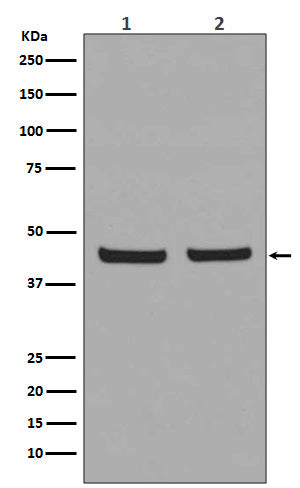 PHD1 Rabbit Polyclonal Antibody