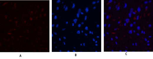JAK3 Rabbit Polyclonal Antibody
