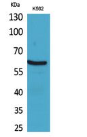 NOX2 Rabbit Polyclonal Antibody