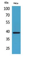 CXCR6 Rabbit Polyclonal Antibody