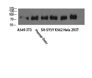 TLE1/2/3/4 Rabbit Polyclonal Antibody