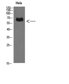 Perforin Rabbit Polyclonal Antibody