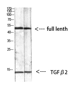 TGF beta 2 Rabbit Polyclonal Antibody