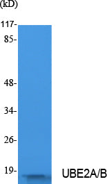 Ubiquitin Conjugating Enzyme E2 A/B Rabbit Polyclonal Antibody