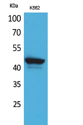 CD1E Rabbit Polyclonal Antibody