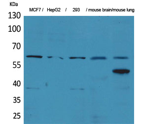 ZNF307 Rabbit Polyclonal Antibody