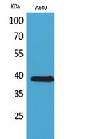 SLC10A1 Rabbit Polyclonal Antibody