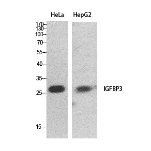 IGFBP3 Rabbit Polyclonal Antibody