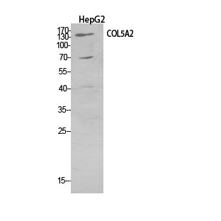 Collagen V alpha 2 Rabbit Polyclonal Antibody