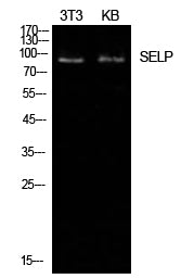 CD62P Rabbit Polyclonal Antibody