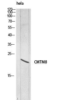 CMTM8 Rabbit Polyclonal Antibody
