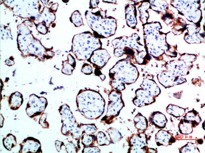 Growth Hormone Rabbit Polyclonal Antibody