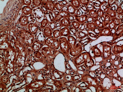 EYA1/4 Rabbit Polyclonal Antibody