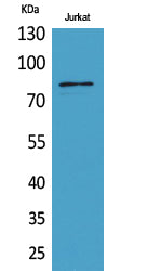 PREP Rabbit Polyclonal Antibody