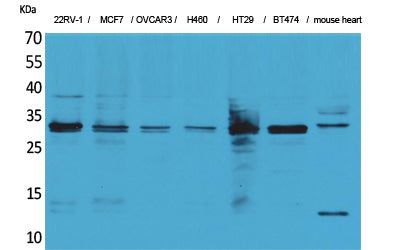 LXN Rabbit Polyclonal Antibody
