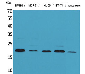 FGF20 Rabbit Polyclonal Antibody