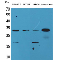FGF18 Rabbit Polyclonal Antibody