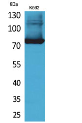 Transferrin Rabbit Polyclonal Antibody